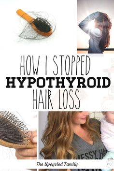 Thyroid Hair, Stop Hair Breakage, Thyroid Symptoms, Thyroid Issues, Lost Hair, Hair Breakage, Natural Treatments, Healthy Habits, Natural Health