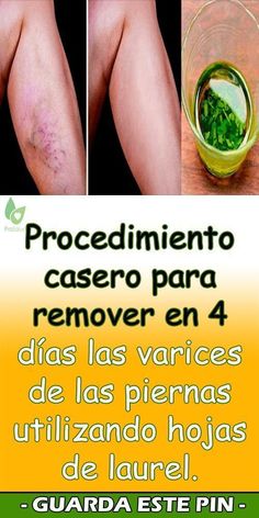 #varices #salud #itas #ara #varicoseveins #vascular #a #escleroterapia #spiderveins #n #piernas #venas #sclerotherapy #varicoseveintreatment #piernascansadas #veins #spiderveinremoval #rices #vascularsurgery #spiderveintreatment #veinremoval #varicose #flebologia #v #medicina #health #veintreatment #healthylegs #veindoctor #angiologia #varices #tratamientodevarices #varicespiernas #piernassanas #piernasbonitas #cremadevarices #foryou #parati #beauty #smoothskin #pielsuave #belleza #us #salud Ginger Oil, Healthy Groceries, Natural Drinks, Health Info, Health Remedies, Herbal Remedies, Home Remedies, Natural Remedies, Cider