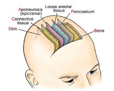 the head and neck are labeled with different types of hair, including an area that has been