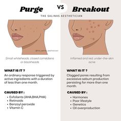 Confused about whether your skin is purging or breaking out? Our guide, "Purge vs. Breakout: Understanding Your Skin's Response," helps clarify these common skin reactions. Learn how to navigate your skincare routine with confidence using the right skin care products and tips. #SkincareRoutine #SkinCareTips #SkinCareProducts #BeautyInsights #ClearSkin Korean Skincare Products, About Skincare, Beauty Supplements, For Skin Care, Male Makeup, Benzoyl Peroxide, Skin Care Shopping, Hair Fragrance