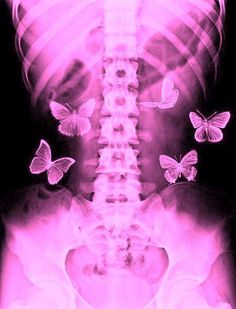 an x - ray image with butterflies flying around it