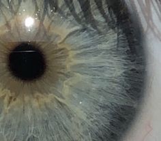 the iris of an eye is shown in this image