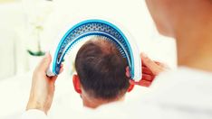 Top 5 Hair Loss Treatments in 2021 for Men Unhealthy Hair, Hair Growth Therapy, Losing Hair, Receding Hair Styles, Hair Transplant Procedure, Hair Science, Thick Hair Growth, Skincare Treatments, New Hair Growth