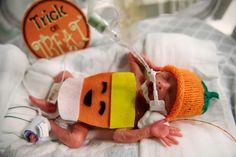 a baby is laying in a hospital bed with an iv drip attached to it's head