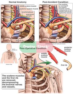 Vertebral Artery, Psoas Release, Anatomy Illustration, First Rib, Drawing Anatomy, Illustration Human, Science Quotes