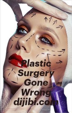 Plastic Surgery Quotes Beauty, Plastic Surgery Video, Plastic Surgery Fail, Plastic Surgery Procedures, Plastic Surgery Memes Humor