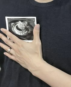 a person with their hand on the side of his chest holding an x - ray