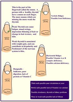 Fingernail Health, Sport Nutrition, Health Signs, Thyroid Health, Nail Health, Natural Health Remedies, Health Info, Health Facts, Fryer Recipes