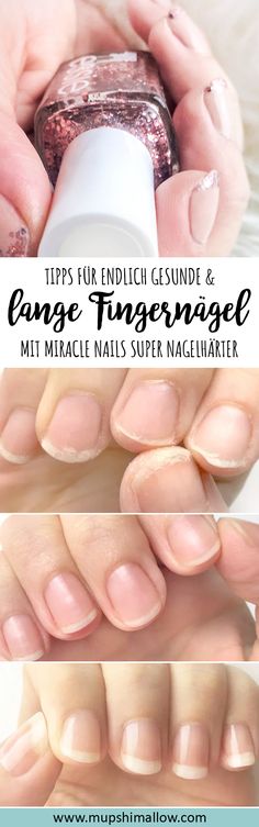 Ganz lange plagen mich schon brüchige und ungesunde Fingernägel die ganz schnell splittern, einreißen und einfach nicht lang wachsen. Kein Nagelhärter hat mir wirklich geholfen. Dank des Miracle Nails Super Nagelhärter habe ich nun endlich feste, lange und gesunde Fingernägel bekommen. Klickt hier für meine Produkt Review und probiert es selber aus! Healthy Fingernails, Natural Acrylic Nails, Nail Hardener, Super Nails, Nails Desing, Healthy Nails, Manicure E Pedicure, Hair Health, Natural Nails