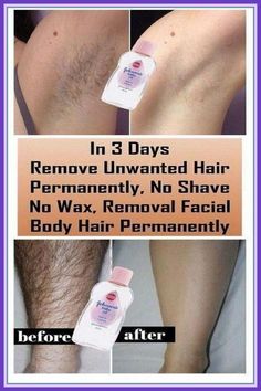 REMOVE UNWANTED HAIR PERMANENTLY - NO SHAVE NO WAX, REMOVAL FACIAL & BODY by Dusan Canevski | This newsletter was created with Smore, an online tool for creating beautiful newsletters for educators, businesses and more Upper Lip Hair Removal, Hair Remove, Best Hair Removal Products