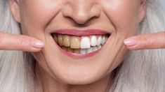 Don’t you want a perfect, white smile? Of course, you do. Who doesn’t?Unfortunately, teeth get yellow with age. It’s a fact. More than that, certain foods an... Holistic Doctor, Whiter Teeth, Whiten Teeth, Health Guru, White Smile, Natural Teeth Whitening, White Teeth, Homemade Skin Care, Wrinkle Remover