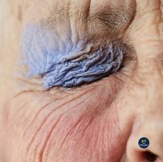 an older woman's eye with wrinkles on the outside of her irise