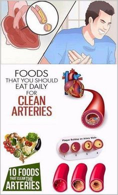 With this secret remedy clean your arteries, lower cholesterol and strengthens your immune system #HealthCareAdviceLine Coconut Health, Clogged Arteries, Fitness Advice, Detox Cleanse, Health And Fitness Tips