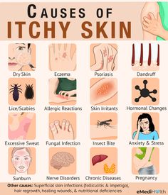 Skin Irritation Remedies, Remedies For Itchy Skin, Dark Skin Around Neck, Feet Reflexology, Woman's Health, Itchy Skin Relief, Nerve Disorders, Face Treatments