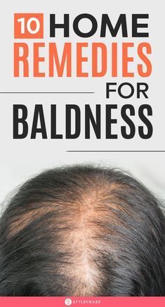 Hair Fall Remedy, Natural Hair Remedies, Natural Hair Growth Remedies, Hair Remedies For Growth, Regrow Hair, Brittle Nails, Hair Control, Lost Hair