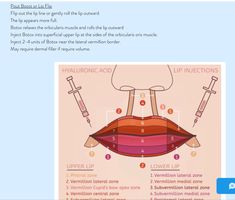 Botox Placement, Hyaluronic Acid Lips, Heal Leaky Gut, Thread Lift, Injectables Fillers, Botox Fillers, Lower Lip
