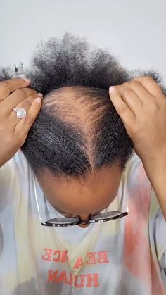 ProtectiveStyles | This is perfect! You’re such a warrior! Thanks for sharing! 🫶���🏾 @pepperpotts1984 I got some work to do on my horomones 💯 PCOS has been a... | Instagram Protective Hairstyles For Thinning Hair, Best Protective Styles For Hair Growth, Kitchen Cardboard, Hair Growth Tips For Black Women, Hair Regrowth Tips, Alopecia Hair Growth, Hair Growth Methods, Coconut Oil Hair Growth, Alopecia Hairstyles