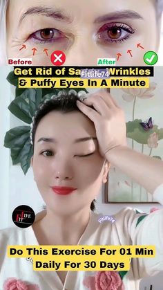 Get Rid of Saggy, Wrinkles & Puffy Eyes In A Min #eyelift #eyeexercise #yoga  #facialyoga #shorts Facial Massage Techniques, Natural Skin Care Remedies, Facial Yoga, Eye Exercises, Hair Remedies For Growth, Yoga Music, Yoga Facial, Eye Lift, Hair Remedies