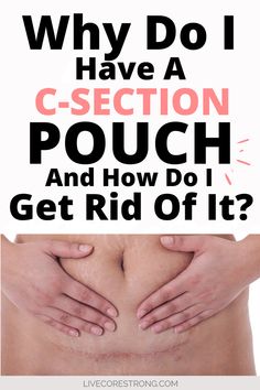 C-section pouch, C-section pooch Workout For C Section Pouch, Get Rid Of Csection Pouch Ab Workouts, After Csection Exercise, Working Out After C Section, Post Partum Recovery Csection, Scar Massage