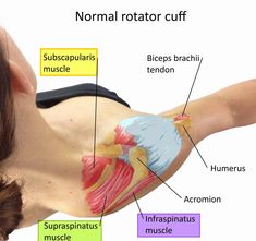 Causes rotator cuff injury & how to prevent rotator cuff injury. Signs & symptoms of rotator cuff injury. How is rotator cuff injury diagnosed & treated Biceps Brachii Muscle, Subscapularis Muscle, Rotator Cuff Pain, Punkty Spustowe, Shoulder Rehab Exercises, Shoulder Anatomy, Rotator Cuff Exercises, Rotator Cuff Surgery