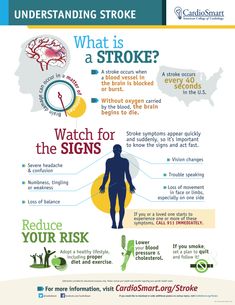 Strokes strike quickly—typically w/o warning. That’s why it’s critical to know the signs of #stroke, and act fast: http://fal.cn/Abrv  #StrokeMonth Infographic Posters, Types Of Strokes, Loss Of Balance, Severe Headache, Infographic Poster, Health And Fitness Tips, Blood Vessels, Do You Know What, Warning Signs