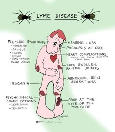 a diagram showing the different types of lymidia and how to use it