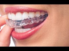 Invisalign Cheap Dental Implants Cost, Teeth Implants, Tooth Extraction