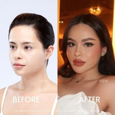 #plasticsurgerybeforeandafter #plasticsurg #surgery #plasticfree #surgerybeforeandafter #surgery_au #1 #instagram #fashion #aesthetic Plastic Surgery Aesthetic, Surgery Aesthetic, Plastic Surgery Gone Wrong, Outfit Elegant, Funny Blogs, Nose Job, Beauty Standards, Plastic Surgeon, Body Hair