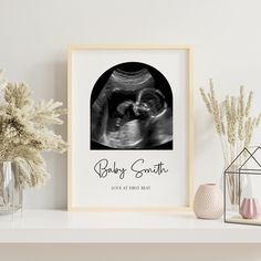 ultrasound print art, watercolor ultrasound print, custom birth keepsake, nursery print , personalized ultrasound baby scan , baby room art Please note every art is different and no two images including background will be the same DIGITAL FILE ONLY Perfect personalized wall art or special creative gift ✤5 Sizes to choose from which a scalable to 18 sizes please advise the size required ✤ * 5 x 7 PDF (approx. 12.7 x 17.8 cm) * 16 x 20 PDF (approx. 41cm x 51cm) SCALABLE TO 4x5 , 8x10 , 12x15 * 18 Ultrasound Art, Ultrasound Frame, Baby Scan, Arch Shape, Baby Room Art, Personalized Wall, Personalized Wall Art, Room Art, Types Of Printer