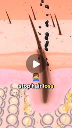 Home Remedies | Grow your hair faster than you thought possible - 3 inches in 7 days!

#naturalremedies #hairgrowth

#hairgrowthtips #haircare... | Instagram Grow Your Hair Faster, Hair Growth Formula, Miracle Grow, How To Grow Your Hair Faster, Grow Long Hair, Longer Hair, Growth Tips, Hair Solutions, Hair Growth Tips