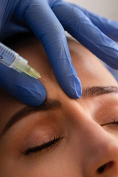 Trusted by countless expert injectors, Botox Cosmetic isn’t just a wrinkle relaxer; it’s a testament to precision and quality. Crafted in a state-of-the-art facility under stringent safety measures, each of […] Botox Photography, Botox Advertising, Botox Aesthetic Photography, Botox Stock Photo, Botox Astetic, Botox Nurse, Botox Aesthetic, Allergan Botox