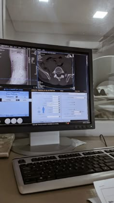 a computer monitor sitting on top of a desk with an x - ray image in the background