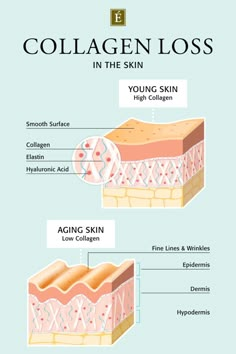 Skin Anatomy, Eminence Organic Skin Care, Skin Care Business, Skin Aesthetics, Skin Science, Young Skin