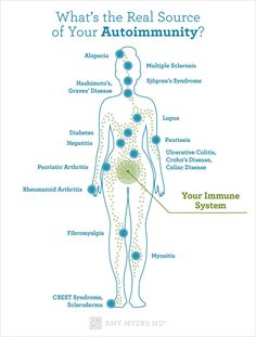 Amy Myers, Foot Reflexology Massage, Health Chart, Lip Care Routine, Reflexology Massage, Estrogen Dominance, Foot Reflexology, Receding Gums