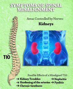 T10 Spinal Misalignment, Chronic Tiredness, Basic Anatomy, Read People, Basic Anatomy And Physiology, Blood Pressure Chart, Spine Health, How To Read People, Medical Studies