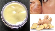 DIY Ginger Cream | Remove Pigmentation, Dark Spots & Acne Scars| Anti-Aging & Skin Lightening Cream Skin Cream Anti Aging, Skin Lightening Cream, Ginger Benefits, Creme Anti Age, Lightening Creams, Skin Lightening, Anti Aging Beauty, Whitening Cream, Anti Aging Cream