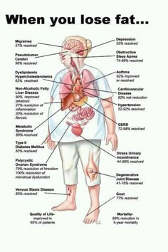 Weight Loss is not just about looking good! Makanan Diet, Diet Keto, The Human Body, Health Info, Reduce Weight, Migraine, Get In Shape, Fitness Diet, Healthy Weight