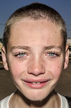 a young boy with freckles on his face