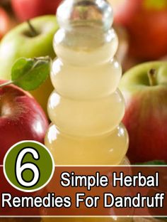 Herbal Remedies For Dandruff: Apple cider vinegar is one of the most effective home ingredients for hair care. Dandruff Remedy, Getting Rid Of Dandruff, Natural Healing Remedies, Home Remedies For Hair, Skin Remedies, Homemade Beauty Products, Natural Medicine, Dandruff, Cider Vinegar