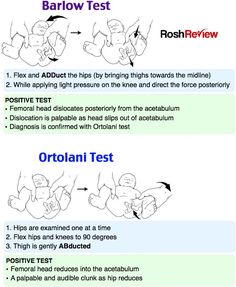 the instructions for how to use an ortoian's test on your baby