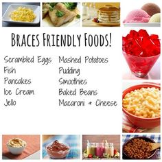 Food Braces Ideas, What To Eat With Braces Food Ideas, Snacks For Braces Ideas, Food For Braces Meals, Braces Friendly Food, Braces Food Ideas, Soft Foods For Dental Work