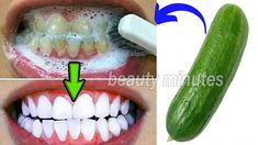 In this video we will show Make your teeth whiter and free of plaque with this awesome, tried and true recipeToday's recipe is how to get rid of built up tar... Tumeric Teeth Whitening, Make Your Teeth Whiter, Teeth Cleaning Routine, White Teeth Tips, Natural Teeth Whitening Diy, Teeth Cleaning Tools, Alcohol Free Mouthwash