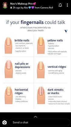 Fingernail Health, Health Signs, Brittle Nails, Nail Health, Manicure Y Pedicure, Trendy Baby, Health And Beauty Tips