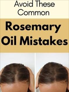 How To Regrow Thinning Hair, Regrowing Hair Women, Essential Oils For Thinning Hair Women, Natural Supplements For Hair Growth, Rosemary Onion Hair, Best Hair Regrowth Products For Women, Natural Hair Thickener, Thinning Front Hair For Women, Tips For Thinning Hair Women