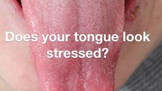 Find out if your tongue is stressed with the Traditional Chinese Medicine method of tongue diagnosis. With examples from our patients who have suffered from ... Organic Health, Diet Meal Plans, Oral Hygiene, Keto Meal Plan