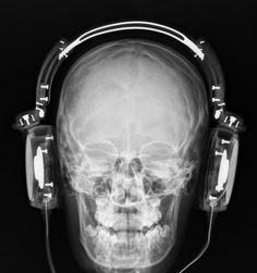 an x - ray image of a human skull wearing headphones and listening to music