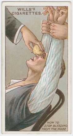 Nose Bleeds, Vintage Medical, Childrens Games, The Nose, Medical History, New York Public Library, Football Cards, Sports Cards, First Aid