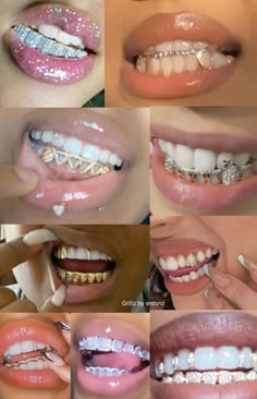 Grill Teeth Female, Grills For Women Teeth, Braces Black Women, Girly Grillz, Grillz Teeth Female, Female Grills, Grillz For Females, Girls With Grills, Girl Grillz