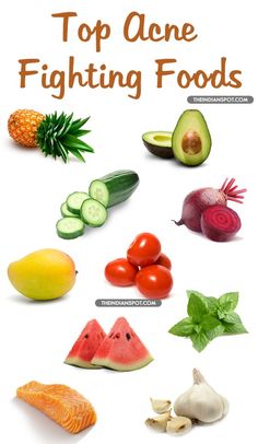 Food For Acne, Foods For Clear Skin, Skin Diet, Bad Diet, Best Beauty Tips, Beauty Foods, Detox Water, Healthy Foods