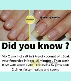 Grow Nails Faster, Nails Homecoming, Nail Care Routine, Brittle Nails, Nail Art Instagram